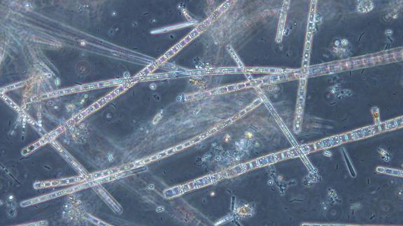 Long, stick-like microscopic algae as seen under a microscope