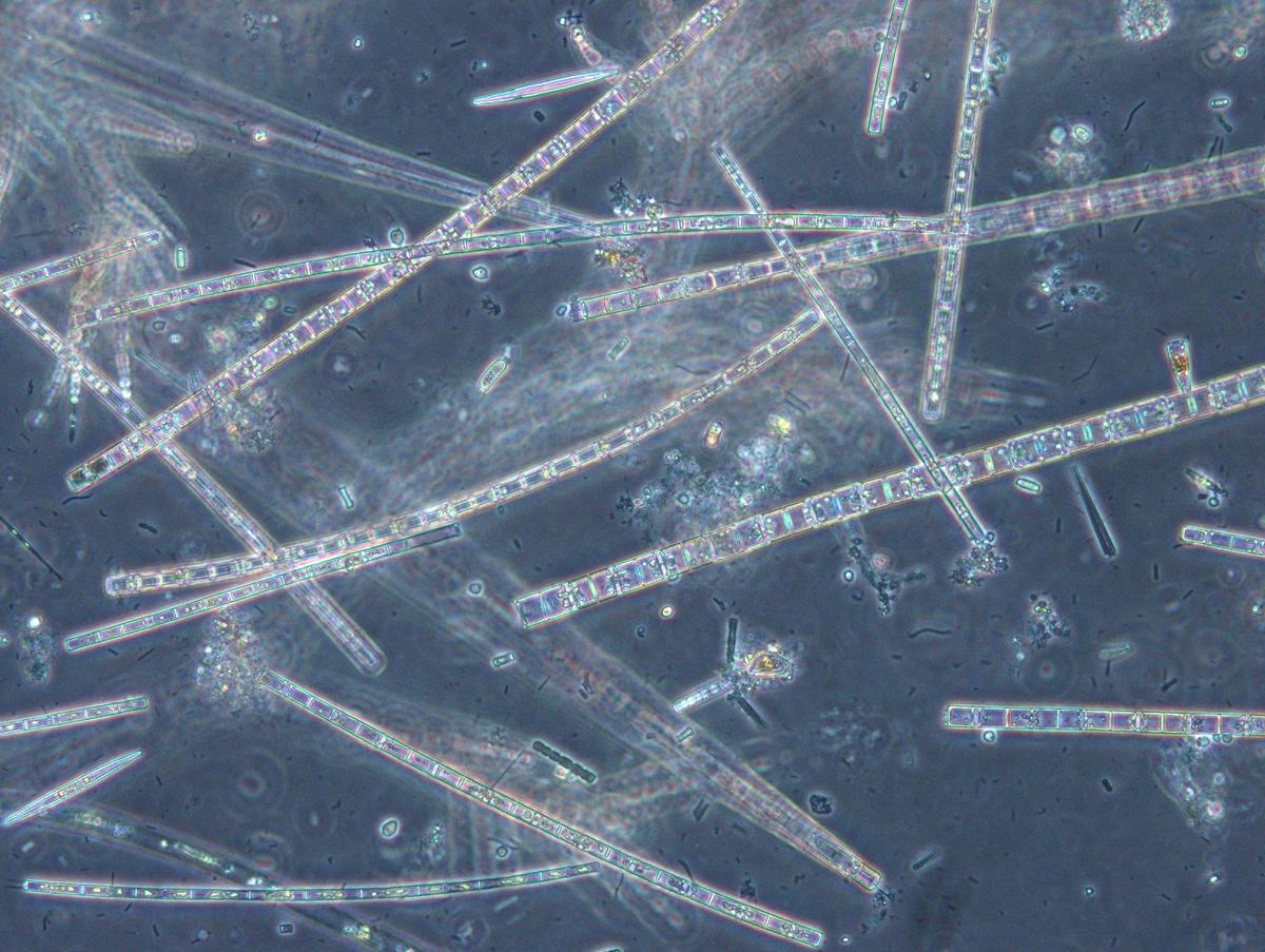 Long, stick-like microscopic algae as seen under a microscope